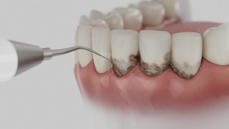 Reliable Teeth Cleaning And Checkup contractor in Sitka City and Borough County, AK by Dentist Open Now